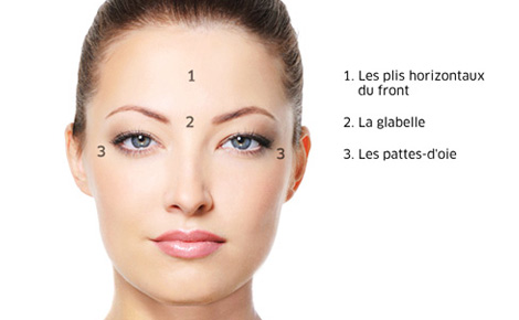 Les zones les plus souvent traitées par BOTOX